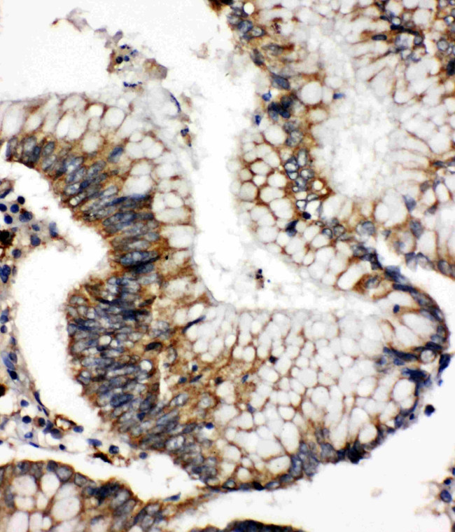 SOD2 (MnSOD) Antibody in Immunohistochemistry (Paraffin) (IHC (P))