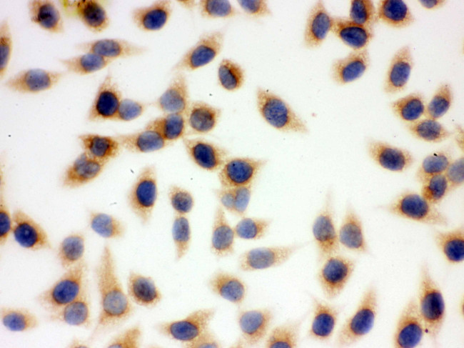 SOD2 (MnSOD) Antibody in Immunocytochemistry (ICC/IF)