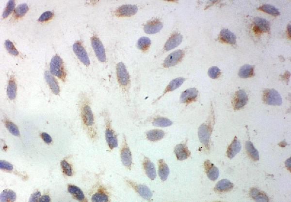 SOD3 Antibody in Immunocytochemistry (ICC/IF)