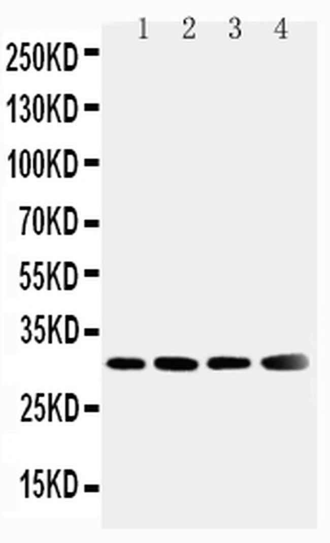 SOD3 Antibody in Western Blot (WB)