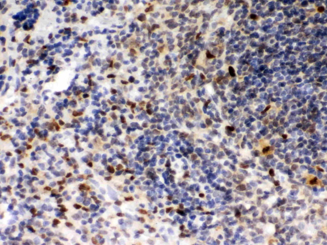 PU.1 Antibody in Immunohistochemistry (Paraffin) (IHC (P))