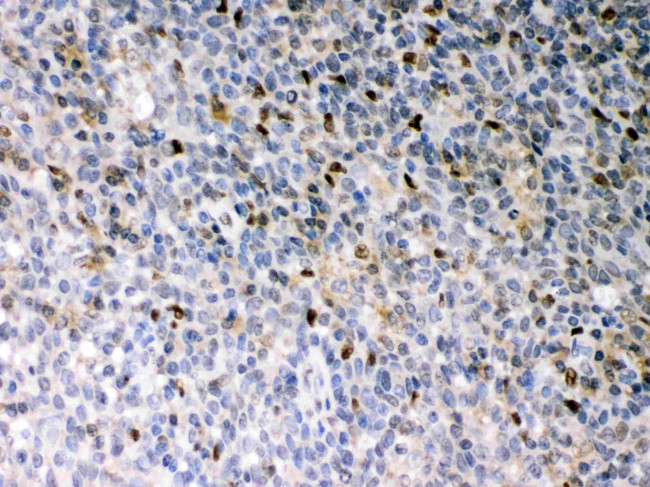 PU.1 Antibody in Immunohistochemistry (Paraffin) (IHC (P))