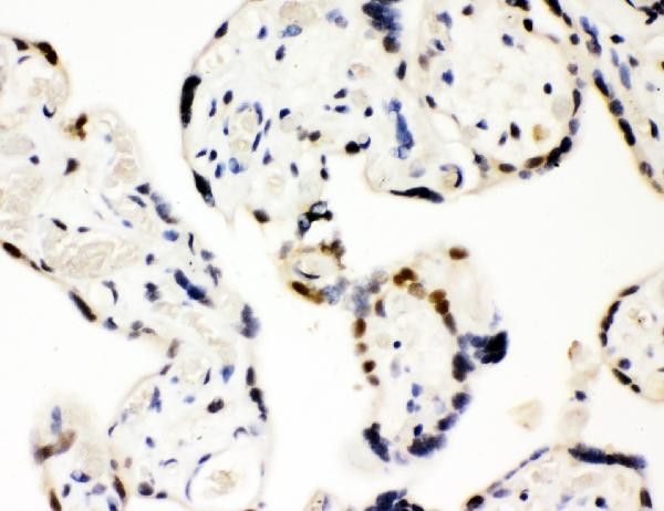 SRSF1 Antibody in Immunohistochemistry (Paraffin) (IHC (P))