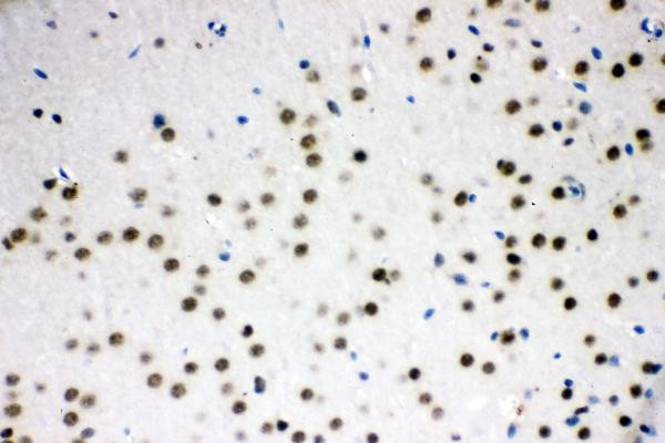 SRSF1 Antibody in Immunohistochemistry (Paraffin) (IHC (P))