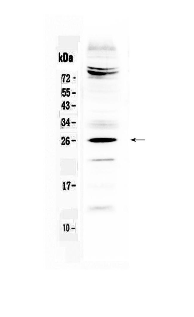 SRY Antibody in Western Blot (WB)