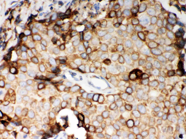 STIM1 Antibody in Immunohistochemistry (Paraffin) (IHC (P))