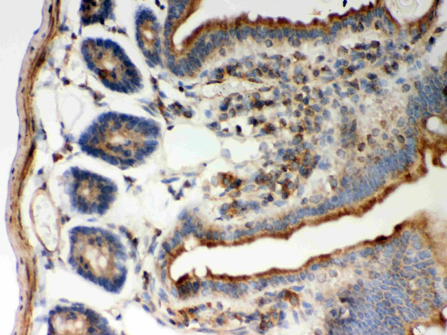 STIM1 Antibody in Immunohistochemistry (Paraffin) (IHC (P))