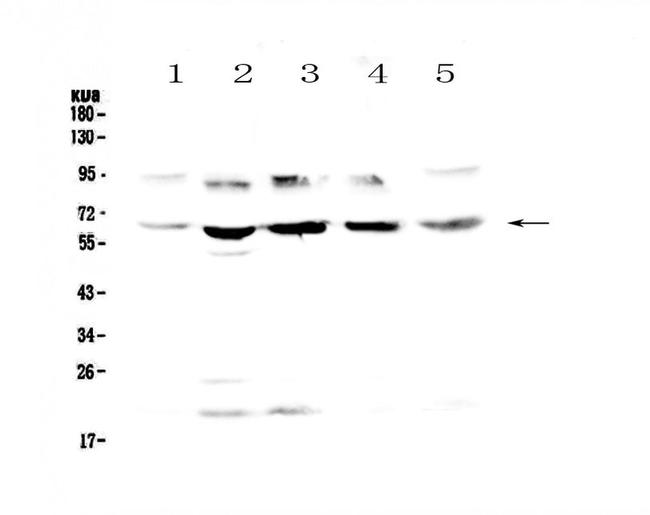 STS Antibody in Western Blot (WB)