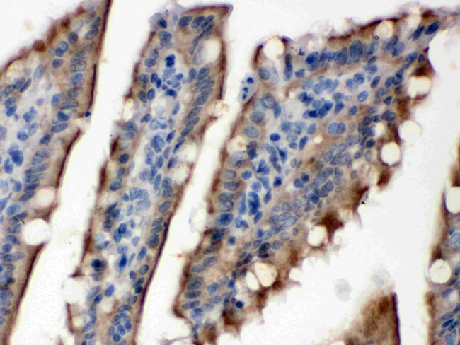 SULT2B1 Antibody in Immunohistochemistry (Paraffin) (IHC (P))