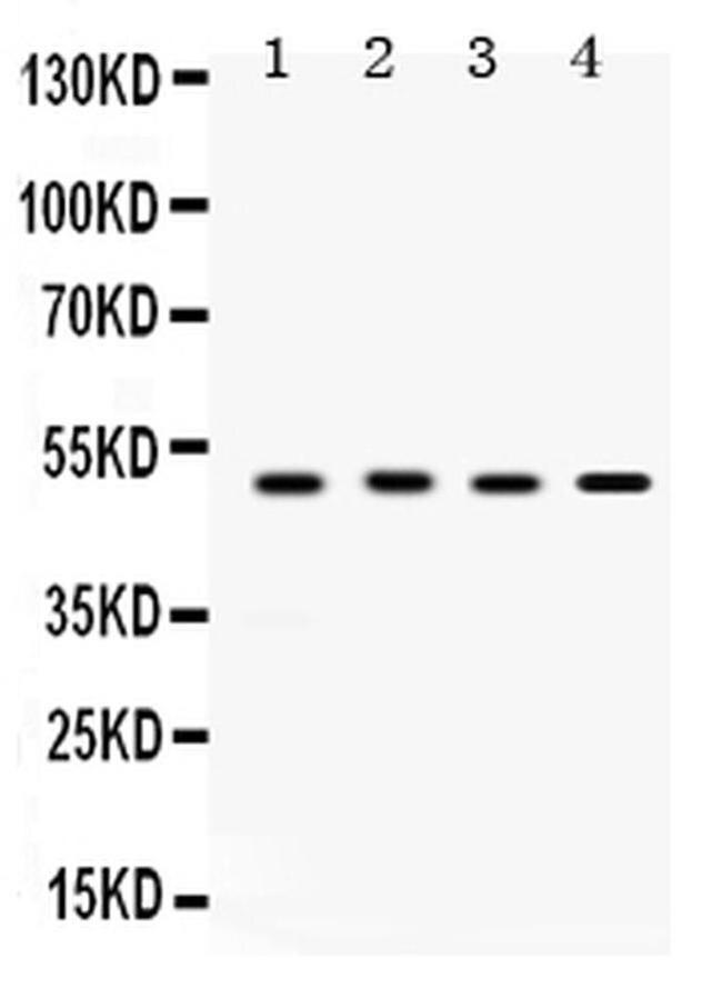 SULT2B1 Antibody in Western Blot (WB)