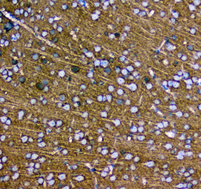 Synaptotagmin 1 Antibody in Immunohistochemistry (Paraffin) (IHC (P))