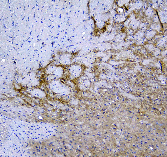 Synaptotagmin 1 Antibody in Immunohistochemistry (Paraffin) (IHC (P))