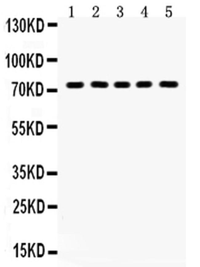 TAB1 Antibody in Western Blot (WB)