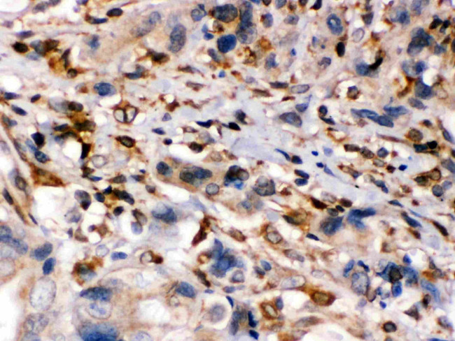 TAP1 Antibody in Immunohistochemistry (Paraffin) (IHC (P))