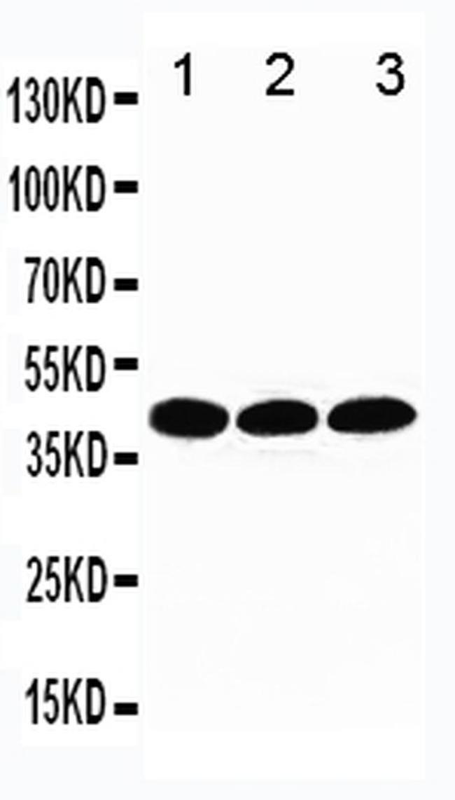 TBP Antibody in Western Blot (WB)