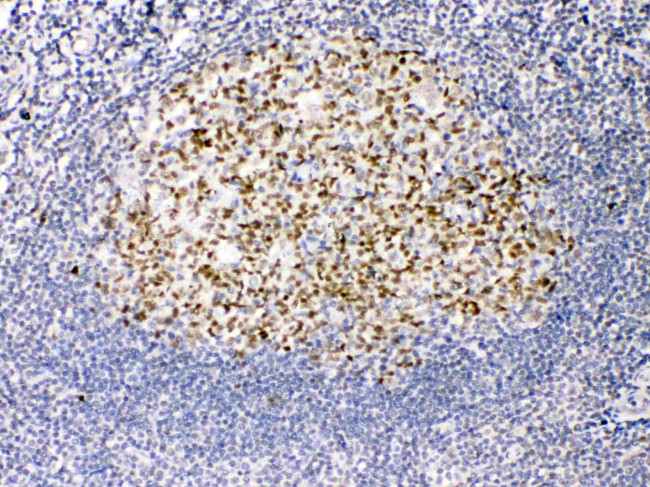 TRF2 Antibody in Immunohistochemistry (Paraffin) (IHC (P))