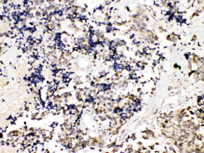 TRF2 Antibody in Immunohistochemistry (Paraffin) (IHC (P))