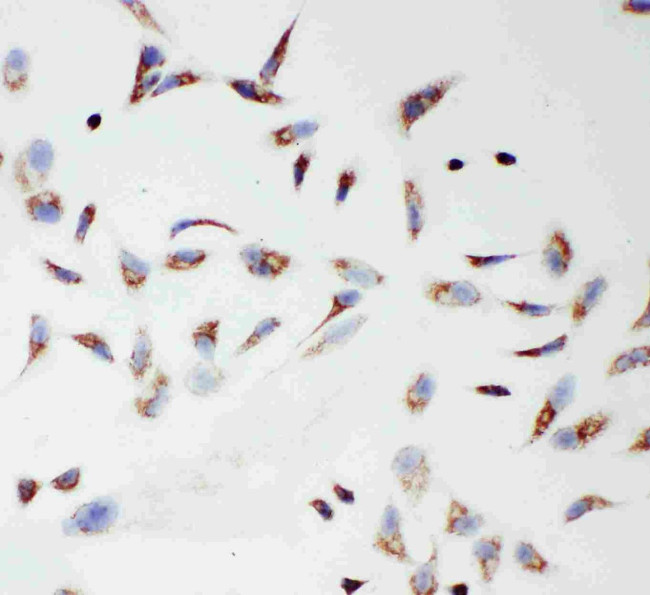 TFAM Antibody in Immunocytochemistry (ICC/IF)