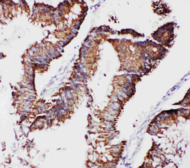 TFAM Antibody in Immunohistochemistry (Paraffin) (IHC (P))