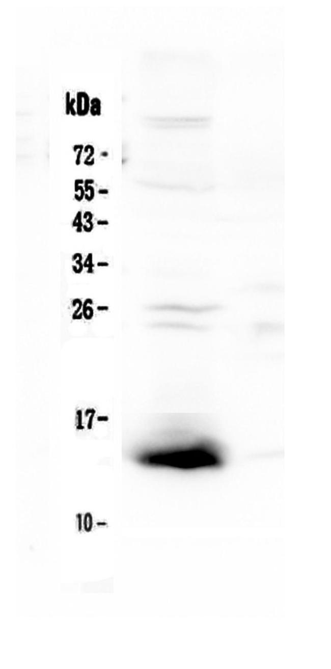 TFF2 Antibody in Western Blot (WB)