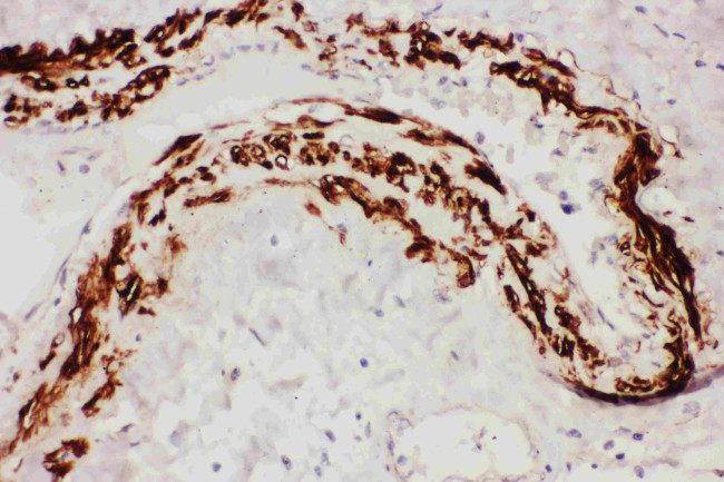 TFPI Antibody in Immunohistochemistry (Paraffin) (IHC (P))