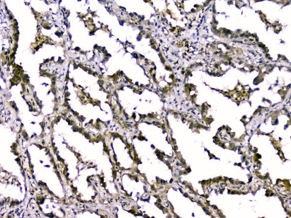 TGF beta-2 Antibody in Immunohistochemistry (Paraffin) (IHC (P))