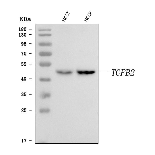 TGF beta-2 Antibody in Western Blot (WB)