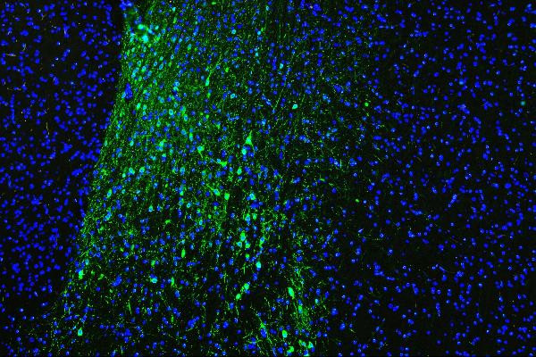 Tyrosine Hydroxylase Antibody in Immunohistochemistry (Paraffin) (IHC (P))