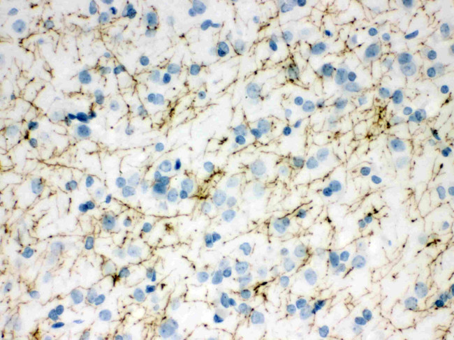 Tyrosine Hydroxylase Antibody in Immunohistochemistry (Paraffin) (IHC (P))