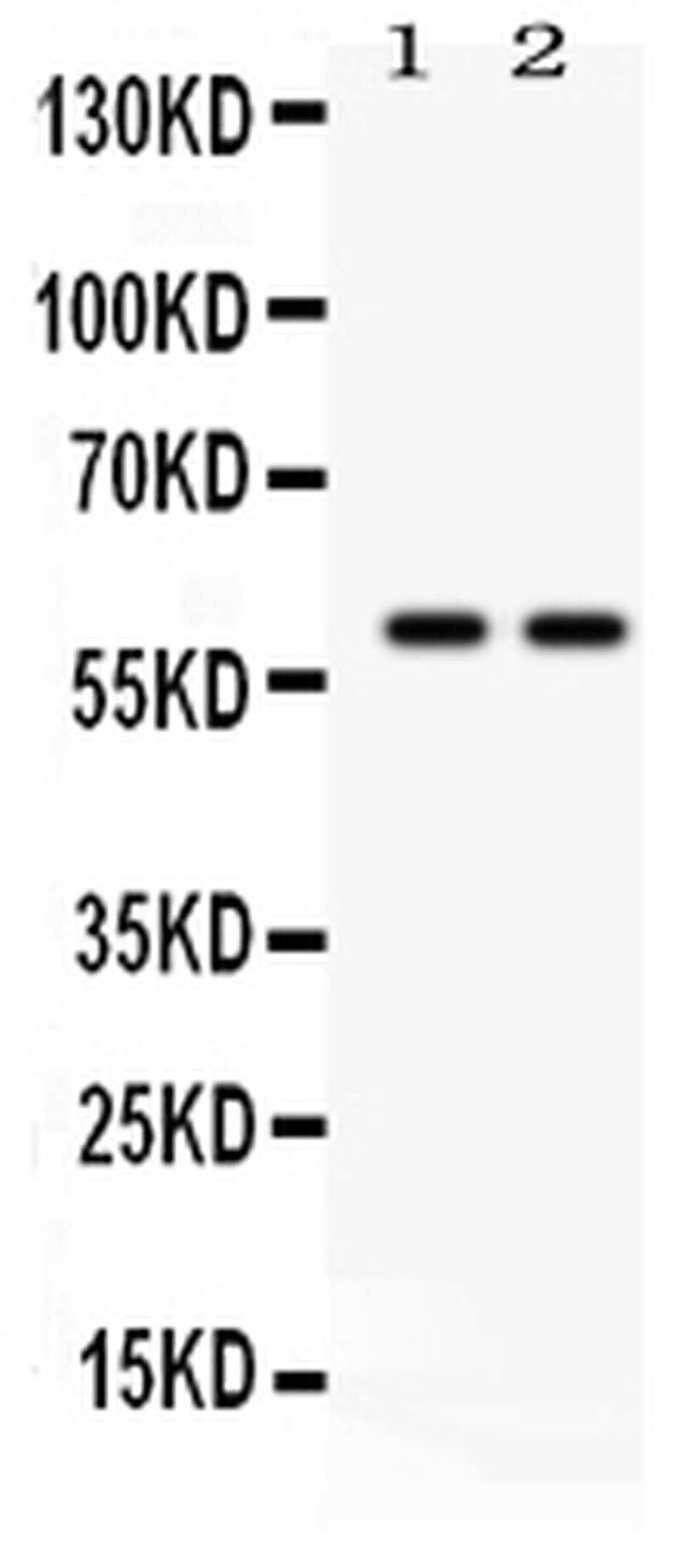 Tyrosine Hydroxylase Antibody in Western Blot (WB)