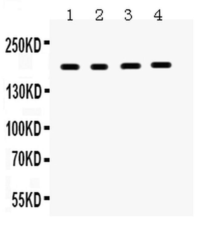 Thrombospondin 1 Antibody in Western Blot (WB)