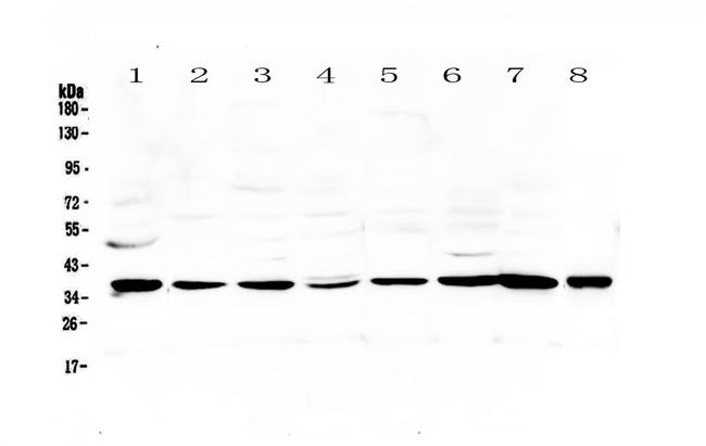 Thrombopoietin Antibody in Western Blot (WB)