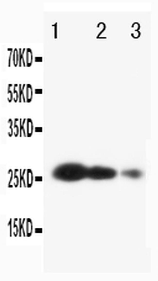 TIMP3 Antibody in Western Blot (WB)