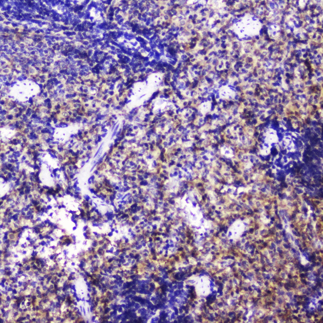 Talin 1 Antibody in Immunohistochemistry (Paraffin) (IHC (P))