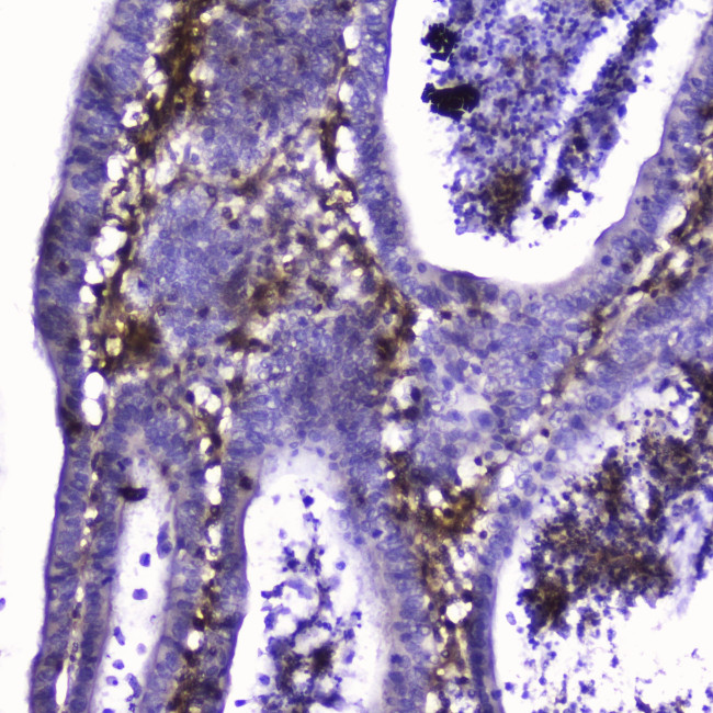 Talin 1 Antibody in Immunohistochemistry (Paraffin) (IHC (P))