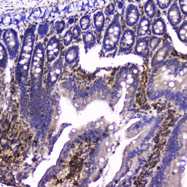 Talin 1 Antibody in Immunohistochemistry (Paraffin) (IHC (P))