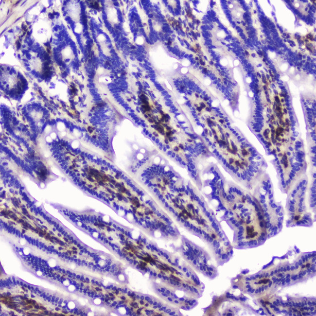 Talin 1 Antibody in Immunohistochemistry (Paraffin) (IHC (P))