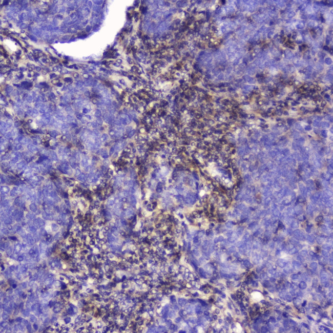 Talin 1 Antibody in Immunohistochemistry (Paraffin) (IHC (P))