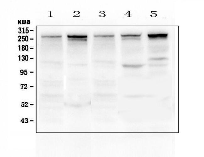 Talin 1 Antibody in Western Blot (WB)