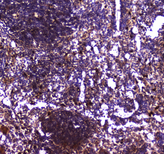 TLR1 Antibody in Immunohistochemistry (Paraffin) (IHC (P))