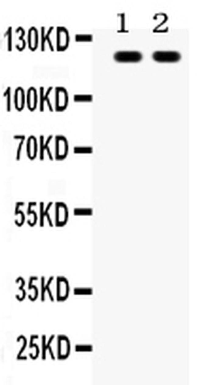 TLR8 Antibody in Western Blot (WB)