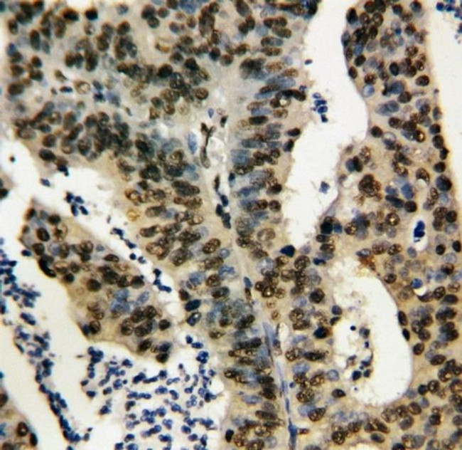 TNFAIP1 Antibody in Immunohistochemistry (Paraffin) (IHC (P))