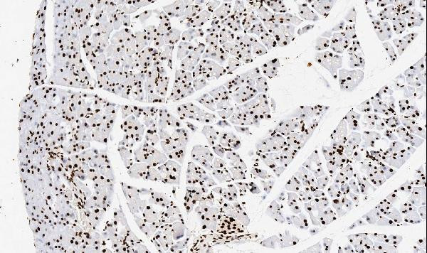 TNFAIP1 Antibody in Immunohistochemistry (Paraffin) (IHC (P))