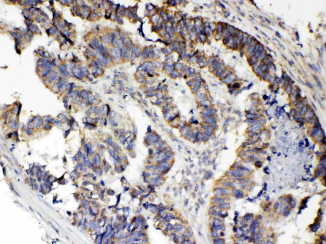 RANK (CD265) Antibody in Immunohistochemistry (Paraffin) (IHC (P))