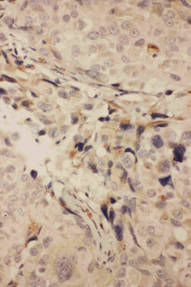 RANK (CD265) Antibody in Immunohistochemistry (Paraffin) (IHC (P))