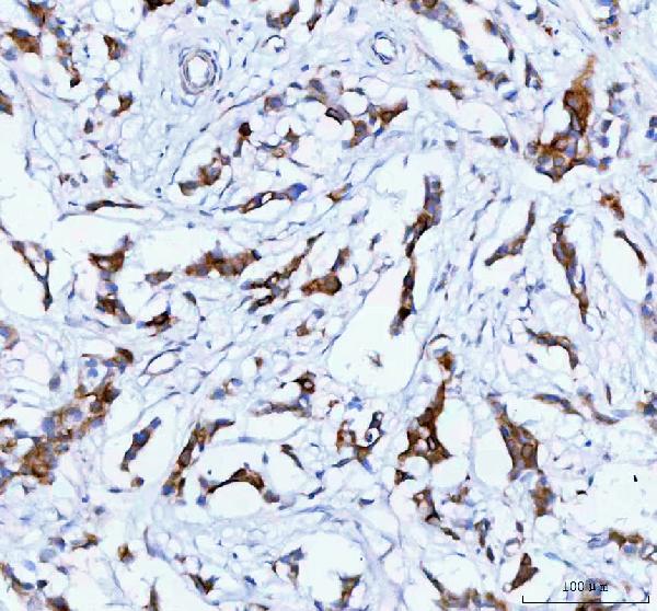 TACI Antibody in Immunohistochemistry (Paraffin) (IHC (P))