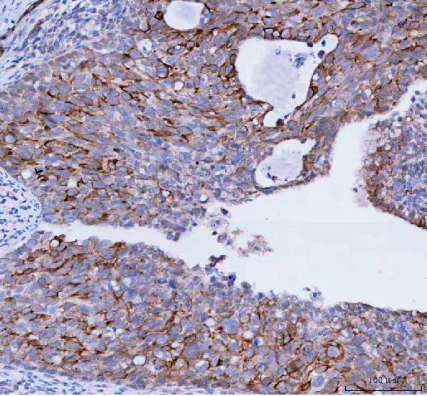 TACI Antibody in Immunohistochemistry (Paraffin) (IHC (P))