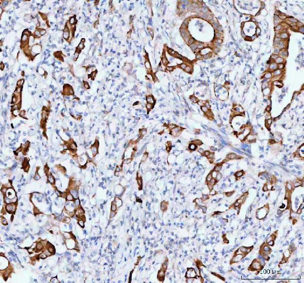 TACI Antibody in Immunohistochemistry (Paraffin) (IHC (P))