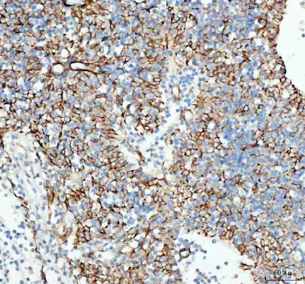 TACI Antibody in Immunohistochemistry (Paraffin) (IHC (P))