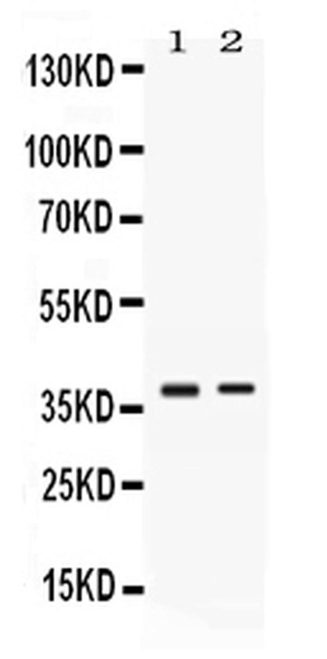 TNFRSF14 (HVEM) Antibody in Western Blot (WB)